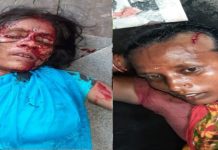 प्रहरी र प्रदर्शनकारीवीच झडप,६ जना घाइते ,नियन्त्रणमा लिन ६ राउण्ड अश्रुग्यास प्रहार